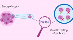 泰国医生建议正常夫妻做PGD的原因是什么？