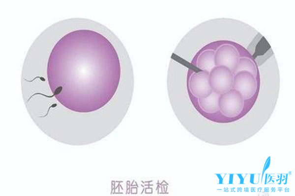 泰国试管婴儿胚胎移植