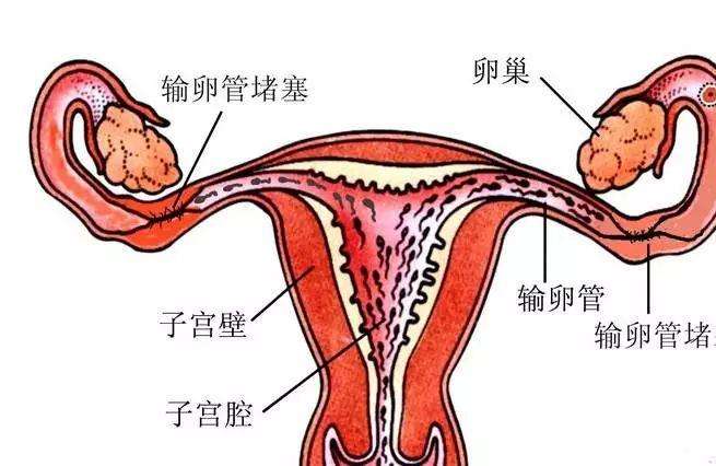 为什么会有输卵管堵塞，还能有自己的孩子吗？